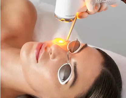 589nmの波長 施術イメージ画像