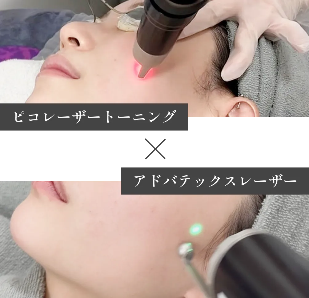 ピコレーザートーニング × アドバテックスレーザー