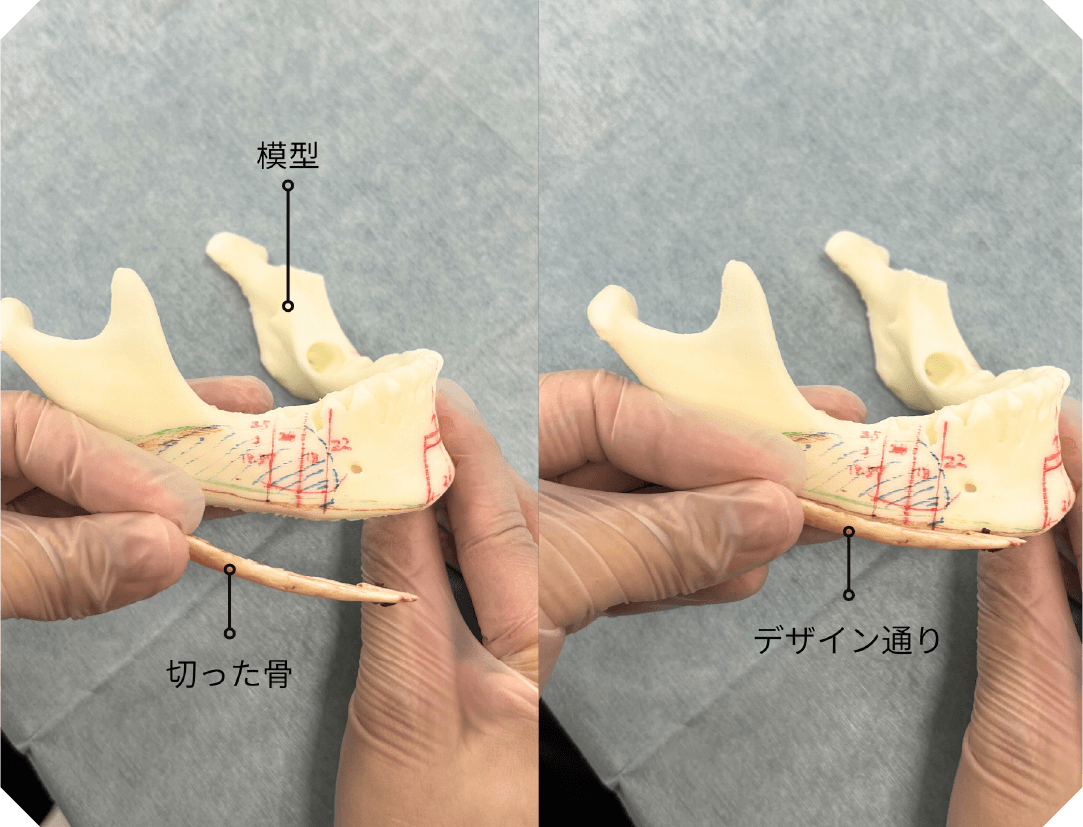 生まれた時から小顔くらい自然な仕上がり