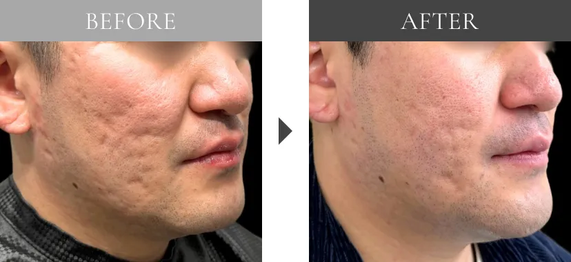 before after