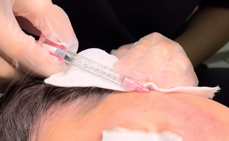 クレーターの深さと層をピンポイントで見極める