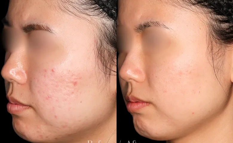 効果のある手技と機械