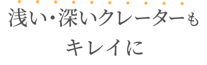 浅い・深いクレーターもキレイに