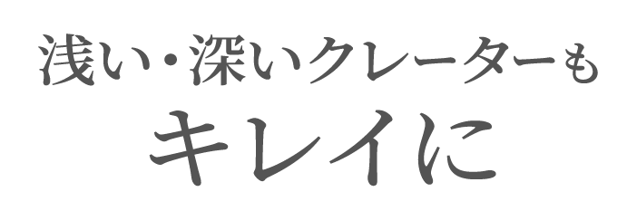 浅い・深いクレーターもキレイにする