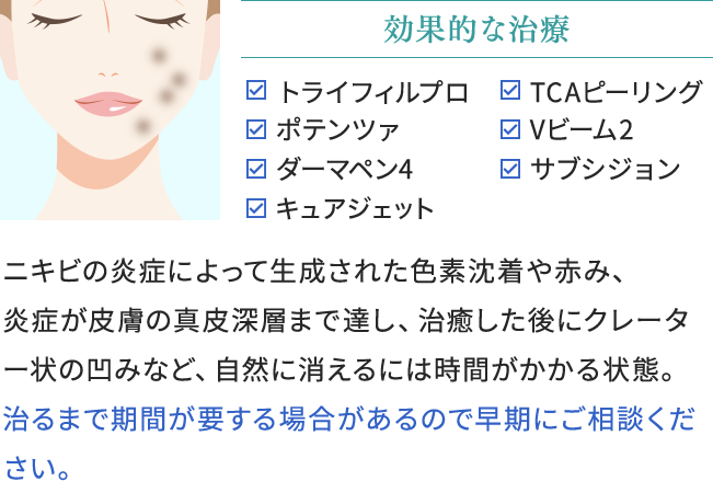 ニキビ跡の効果的な治療