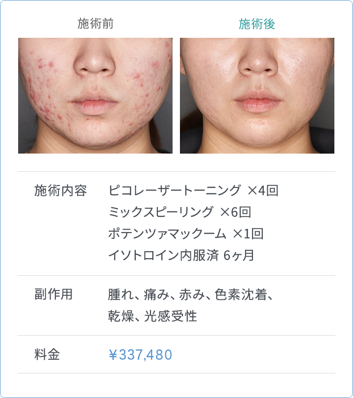 CASE1 施術内容