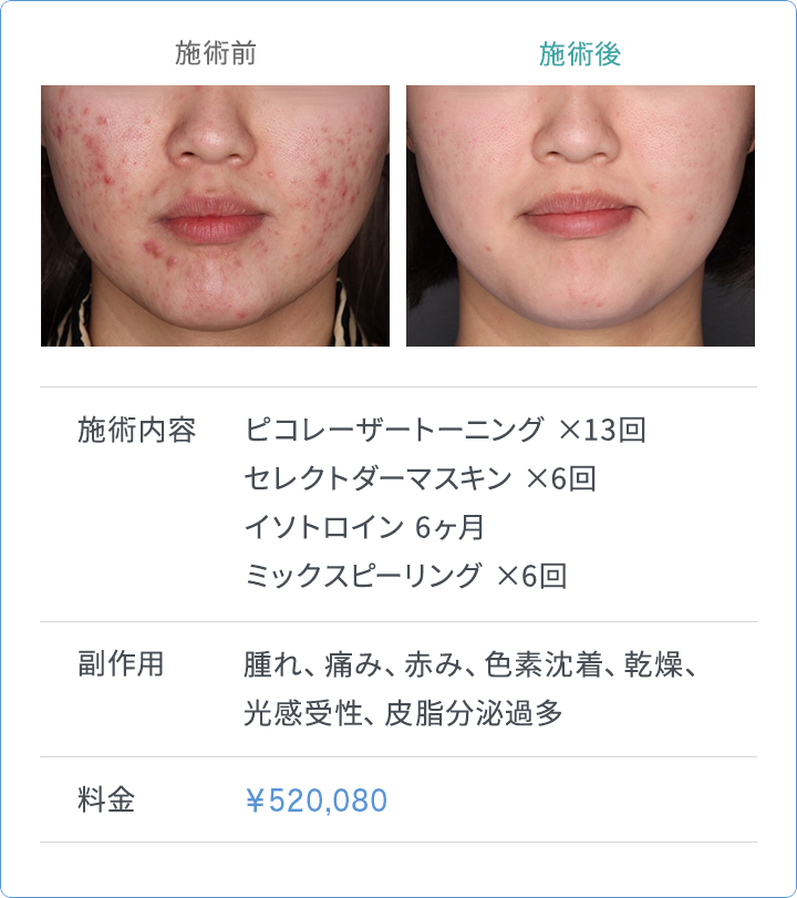CASE2 施術内容