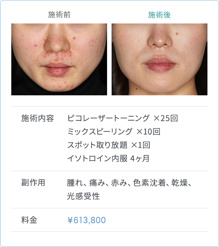 CASE3 施術内容
