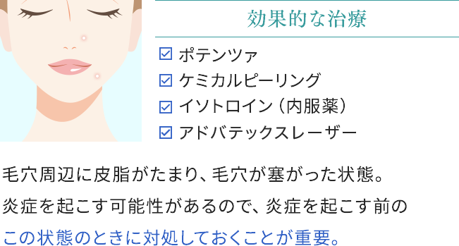 白ニキビの効果的な治療