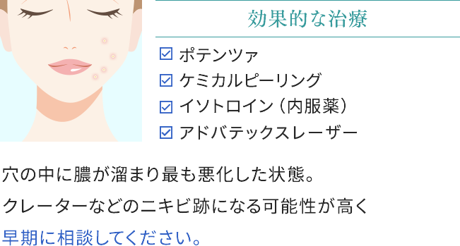 黄ニキビの効果的な治療