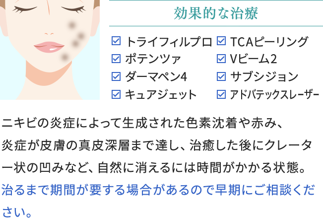 ニキビ跡の効果的な治療