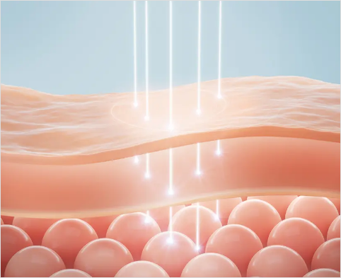 不自然さを感じさせない「内側からのタイトニング」