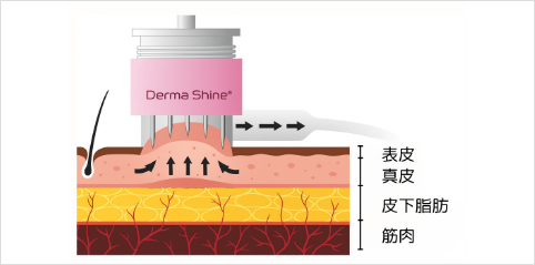 施術時の刺激を抑える工夫