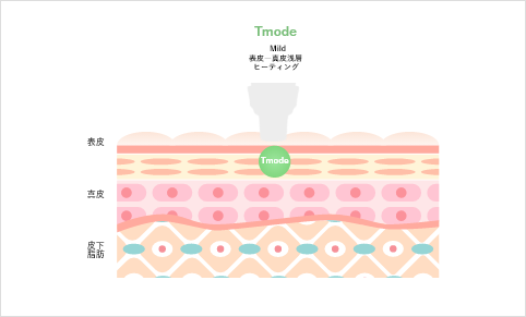 Tモード