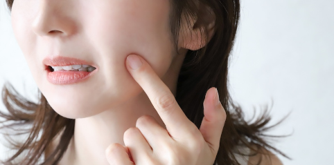 しわの改善