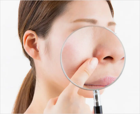 毛穴の目立ちへのアプローチ