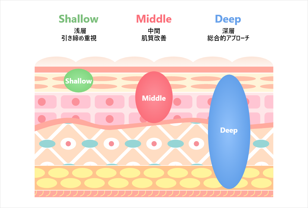 XERF（ザーフ）3つの照射モード