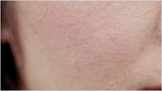 小じわの目立ちにくさ