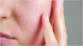 毛穴の引き締まり