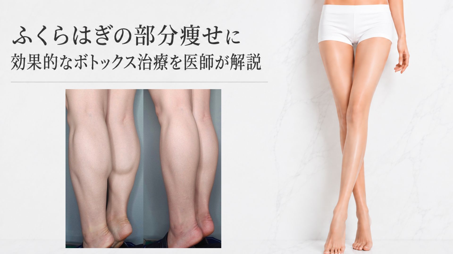 ふくらはぎ　部分痩せ