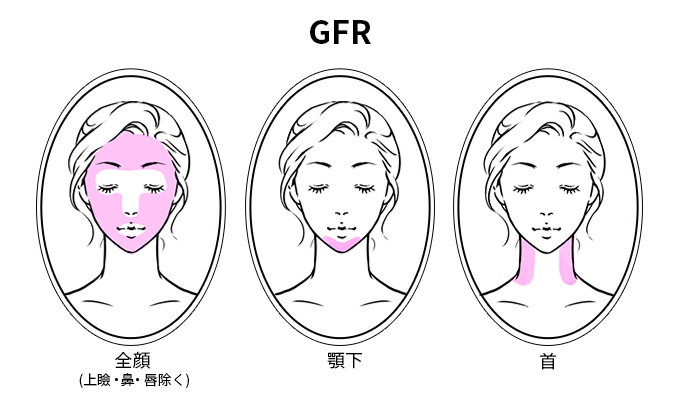 イントラジェン/GFR施術部位