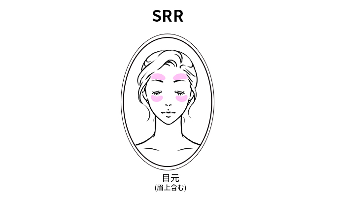 イントラセル/SRR施術部位