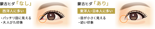 蒙古ひだ