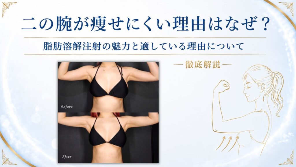 二の腕　脂肪溶解注射