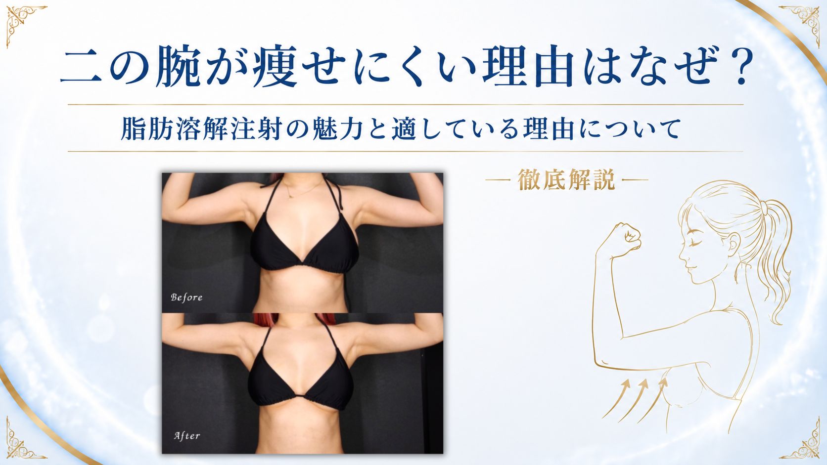 二の腕　脂肪溶解注射