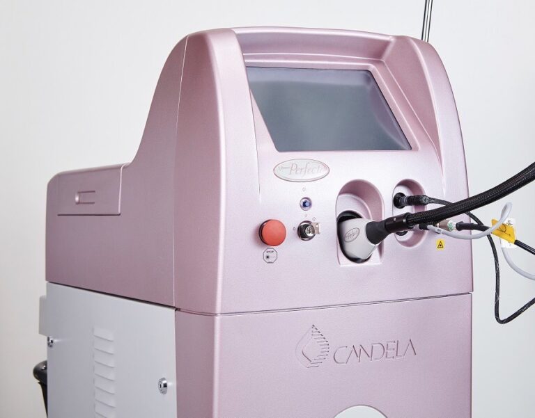 ビフォーアフター有｜Vビーム2 治療の特徴や機能面について解説