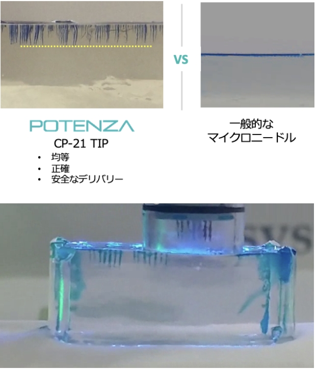 ドラッグデリバリーシステムについて