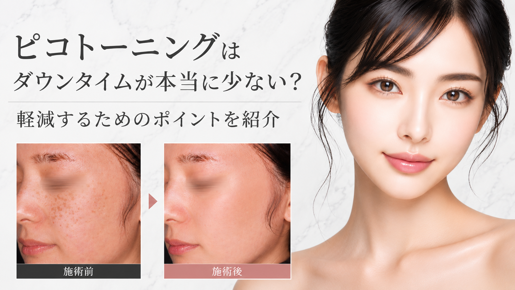 ピコトーニング　ダウンタイム