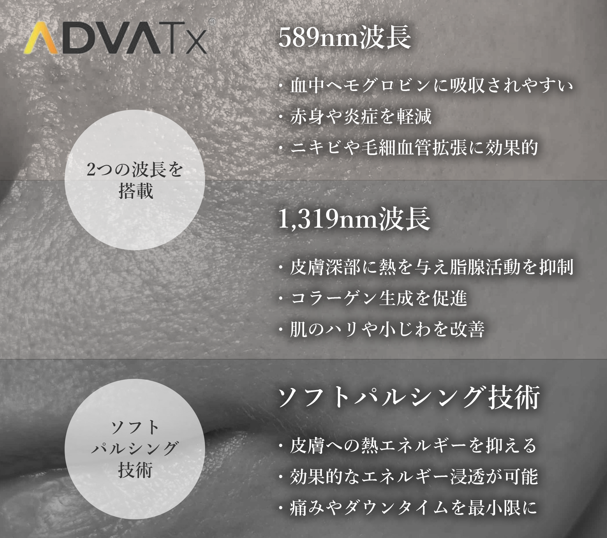 アドバテックスレーザー