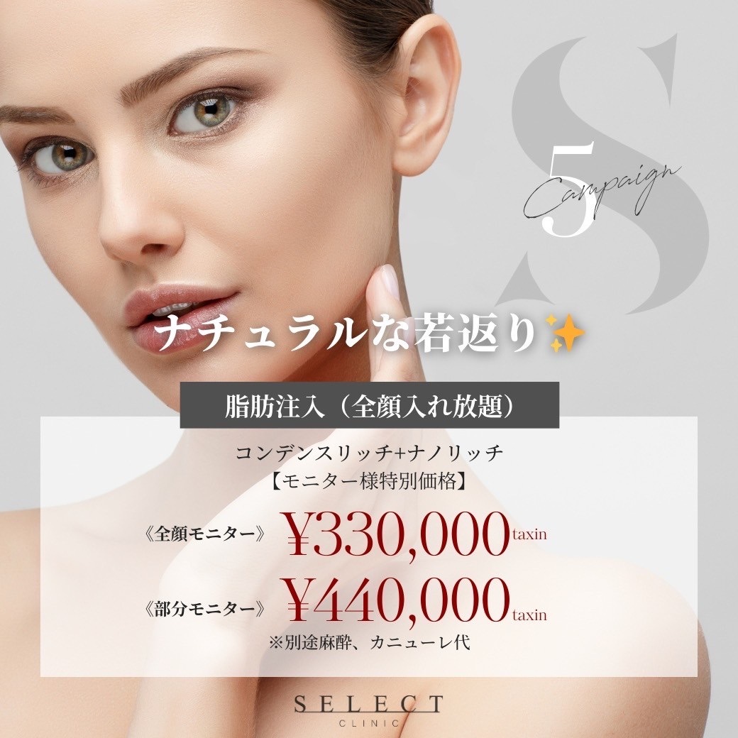 今月のキャンペーン