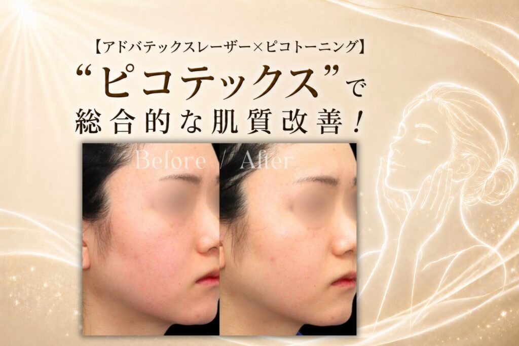 ピコテックス　肌質改善