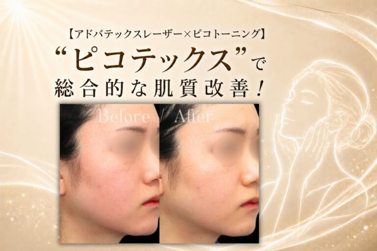 【アドバテックスレーザー×ピコトーニング】“ピコテックス”で総合的な肌質改善！
