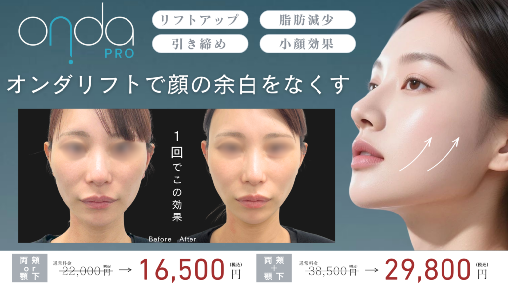オンダリフト(オンダプロ)