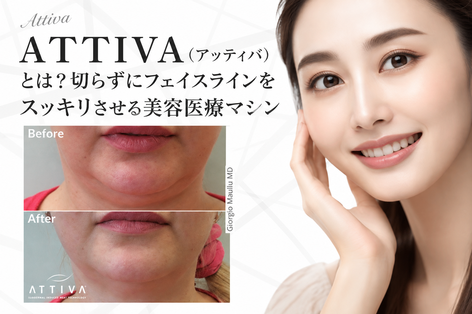 アッティバ　とは