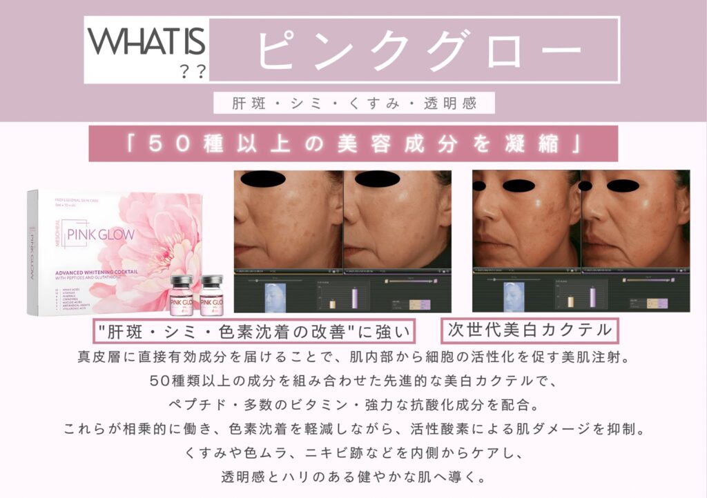 ピンクグロー（Pink Glow）導入のお知らせ | 【公式】セレクト