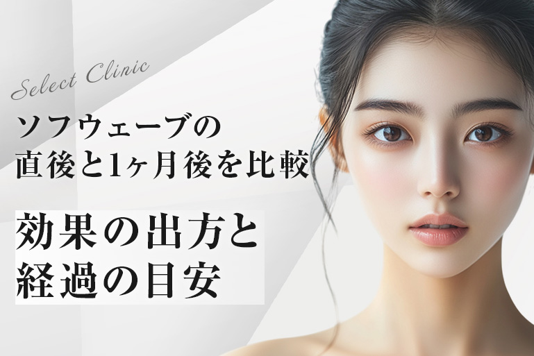 ソフウェーブの直後と1ヶ月後を比較｜効果の出方と経過の目安