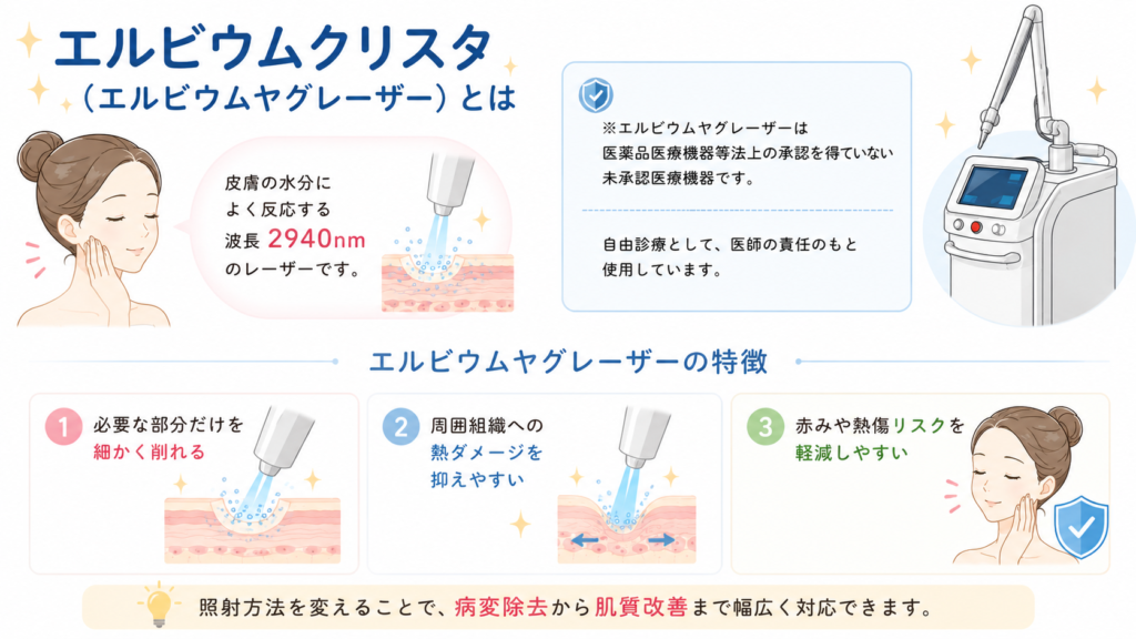 エルビウムクリスタ　エルビウムヤグレーザー　とは