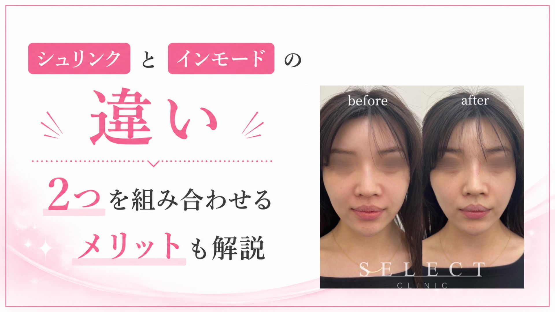 シュリンク　インモード　違い