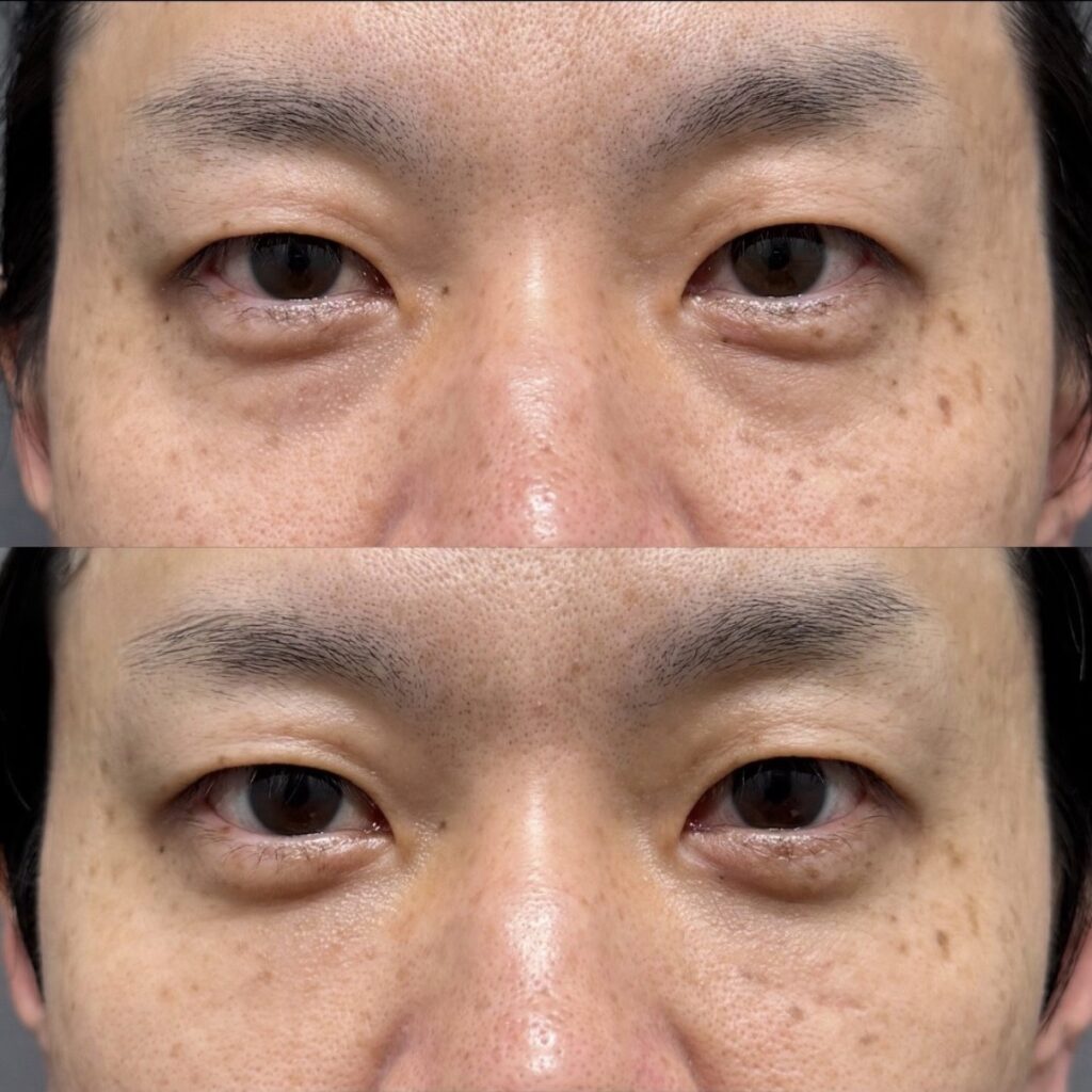 裏ハムラ