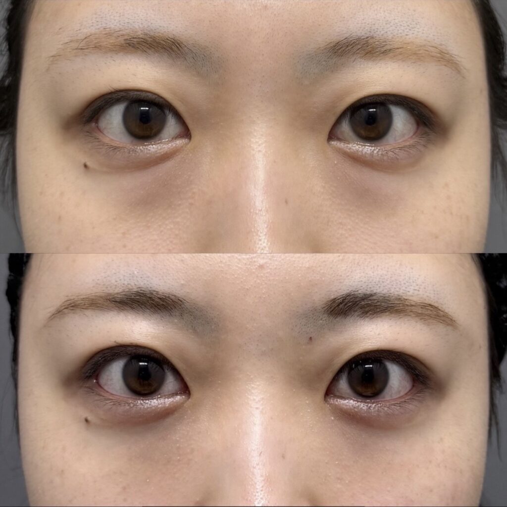 裏ハムラ