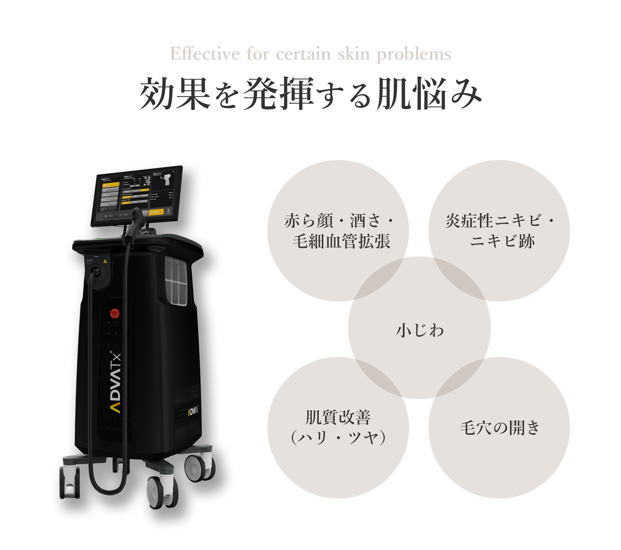 アドバテックスレーザー