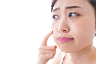 ニキビ跡を消す方法はある？クレーターにさよなら