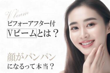 ビフォーアフター付｜Vビームとは？顔がパンパンになるって本当？