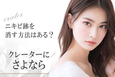 ニキビ跡を消す方法はある？クレーターにさよなら