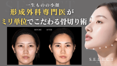 骨切り術による輪郭形成｜本質的な小顔治療をお探しなら