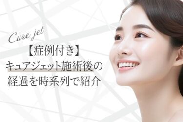 【症例付き】キュアジェット施術後の経過を時系列で紹介